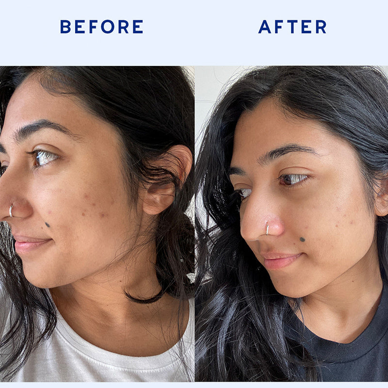 Balance-Restoring-Serum