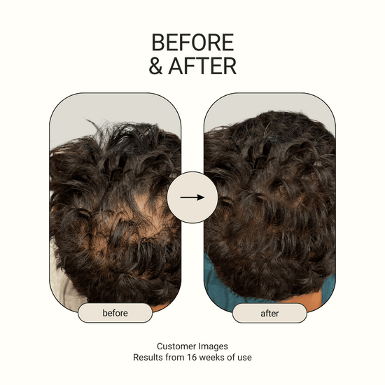 hair growth oil - before & after